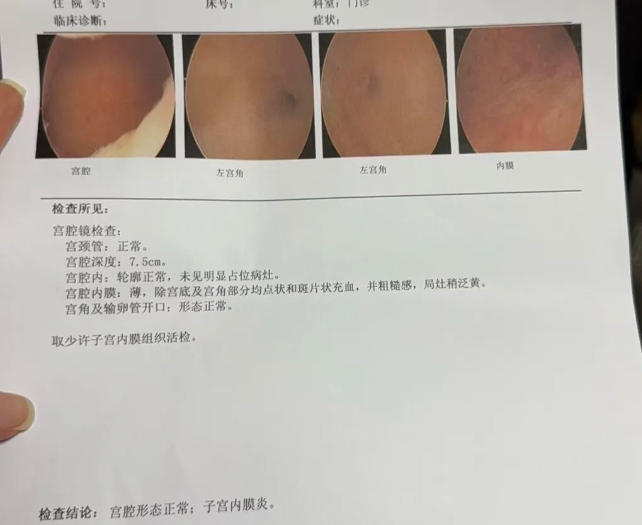 反复种植失败，原因竟是子宫内膜炎