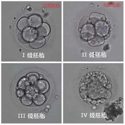 胚胎实验室的“生命闯关”第二篇：胚胎的发育与评级